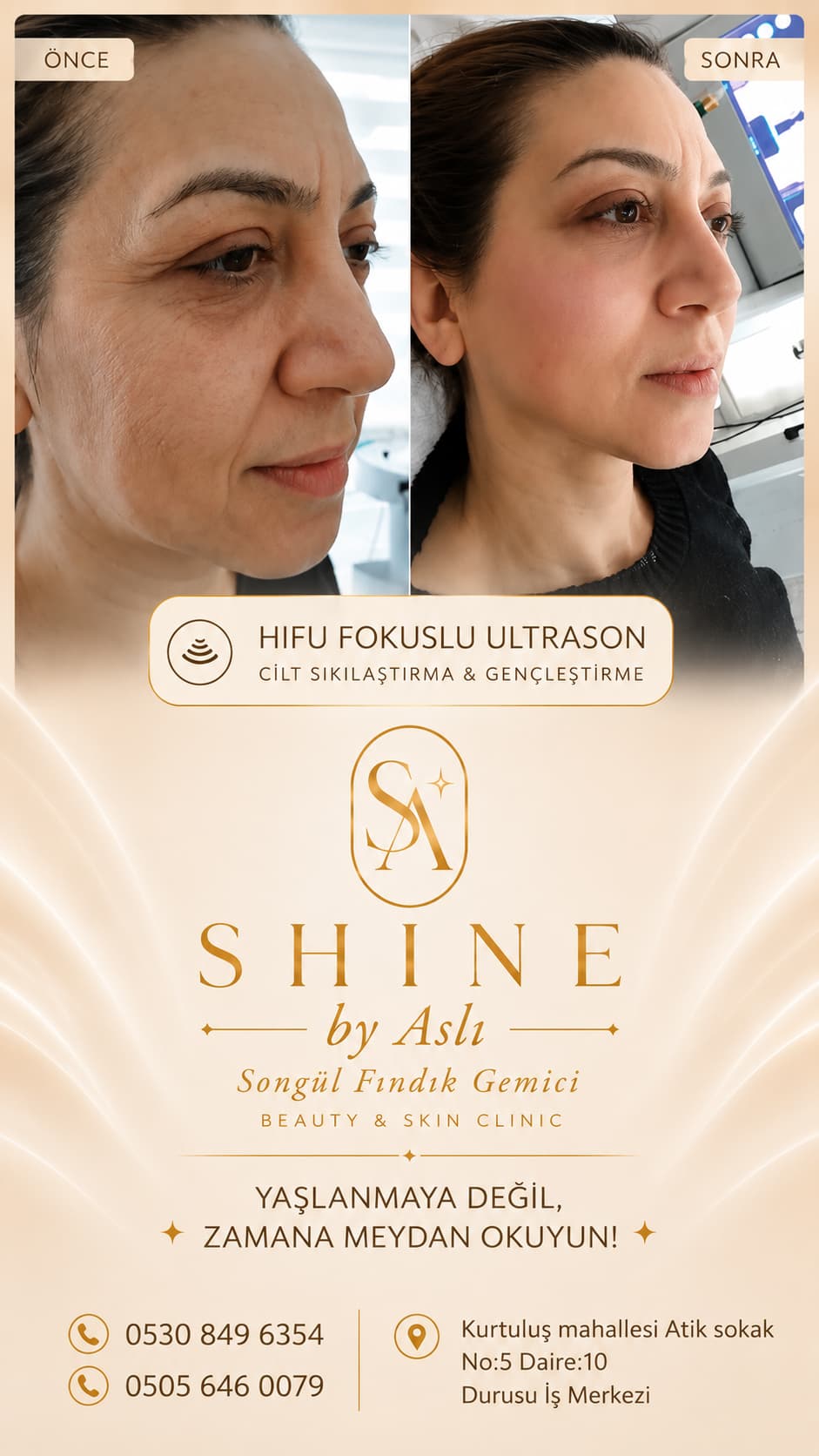 Shine By Beauty 4